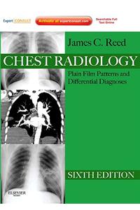 Chest Radiology