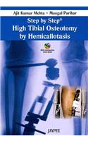 Step by Step: High Tibial Osteotomy by Hemicallotasis