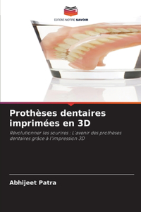 Prothèses dentaires imprimées en 3D