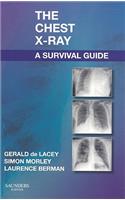 Chest X-Ray: A Survival Guide