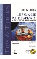 Tips and Tricks in Hip and Knee Arthroplasty