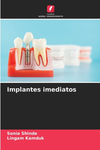 Implantes imediatos