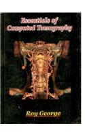 Essentials of Computed Tomography