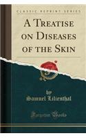 A Treatise on Diseases of the Skin (Classic Reprint)