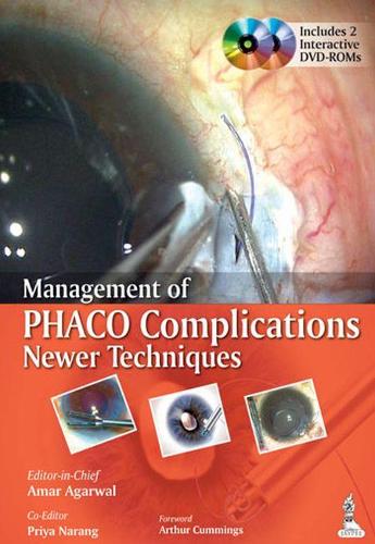 Management of Phaco Complications