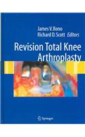 Revision Total Knee Arthroplasty