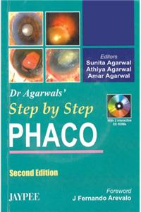 DR AGARWAL S STEP BY STEP PHACO