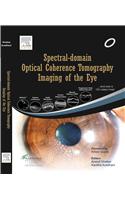 Spectral Domain Optical Coherence Tomography Imaging of the Eye