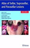 Atlas of Sellar, Suprasellar, and Parasellar Lesions