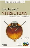 Step by Step: Vitrectomy