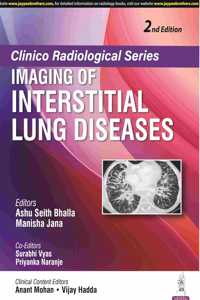 Clinico Radiological Series: Imaging of Interstitial Lung Diseases