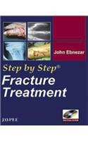 Step by Step: Fracture Treatment