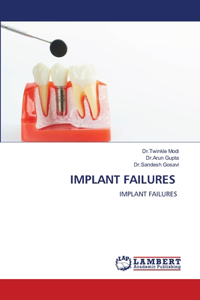 Implant Failures