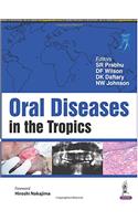 Oral Diseases in the Tropics