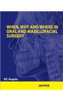 When, Why and Where in Oral and Maxillofacial Surgery