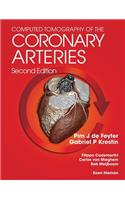 Computed Tomography of the Coronary Arteries