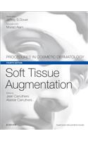 Soft Tissue Augmentation