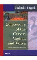 Colposcopy of the Cervix, Vagina, and Vulva