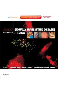 Atlas of Sexually Transmitted Diseases and AIDS