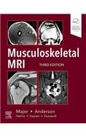 Musculoskeletal MRI