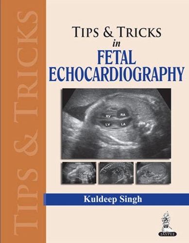 Tips & Tricks in Fetal Echocardiography
