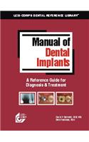 Manual of Dental Implants