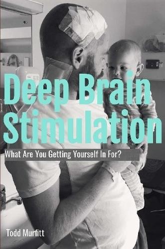 Deep Brain Stimulation - What are you getting yourself in for?