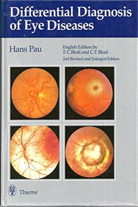 Differential Diagnosis of Eye Diseases