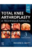 Total Knee Arthroplasty