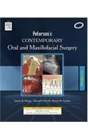 Contemporary Oral And Maxillofacial Surgery