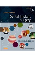 Color Atlas of Dental Implant Surgery