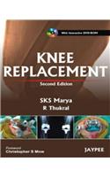 Knee Replacement [with DVD Rom]