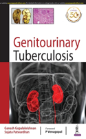 Genitourinary Tuberculosis