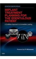 Implant Treatment Planning for the Edentulous Patient