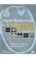Magnetic Resonance Imaging of Neurological Diseases in Tropics