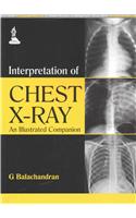 Interpretation of Chest X-Ray