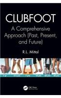 Clubfoot