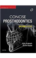 Concise Prosthodontics