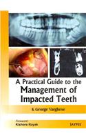 A Practical Guide to the Management of Impacted Teeth
