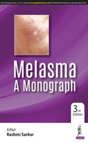 Melasma: A Monograph