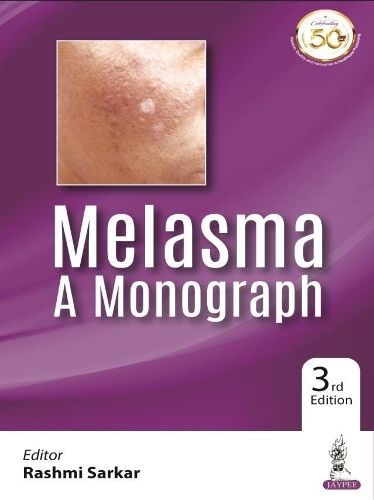 Melasma: A Monograph