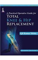 A Practical Operative Guide for Total Knee and Hip Replacement