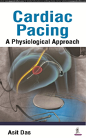 Cardiac Pacing A Physiological Approach