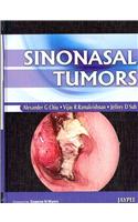 Sinonasal Tumors