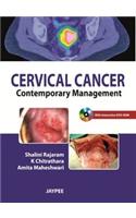 Cervical Cancer