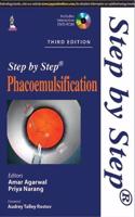 Step by Step Phacoemulsification