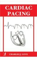 Cardiac Pacing