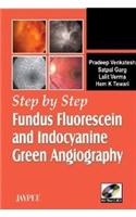 Step by Step (R) Fundus Fluorescein and Indocyanine Green Angiography