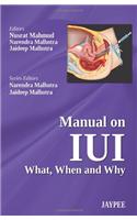 Manual on IUI: What, When and Why