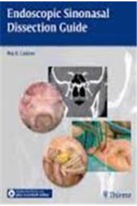 Endoscopic Sinonasal Dissection Guide